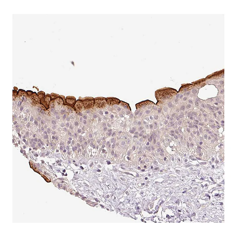 Atlas Antibodies Anti-SLC29A3 Antibody