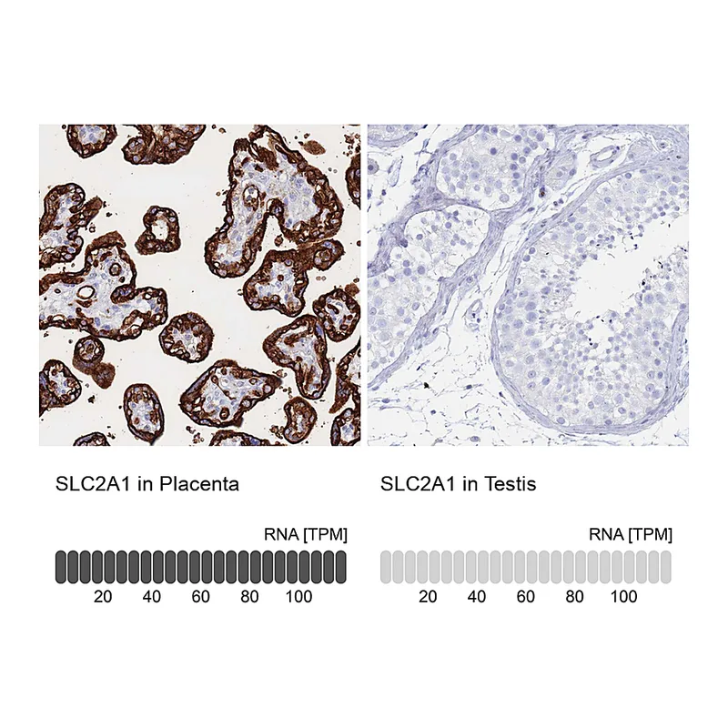 Atlas Antibodies Anti-SLC2A1 Antibody