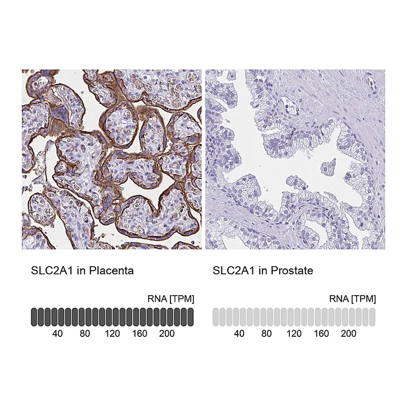Atlas Antibodies Anti-SLC2A1 Antibody