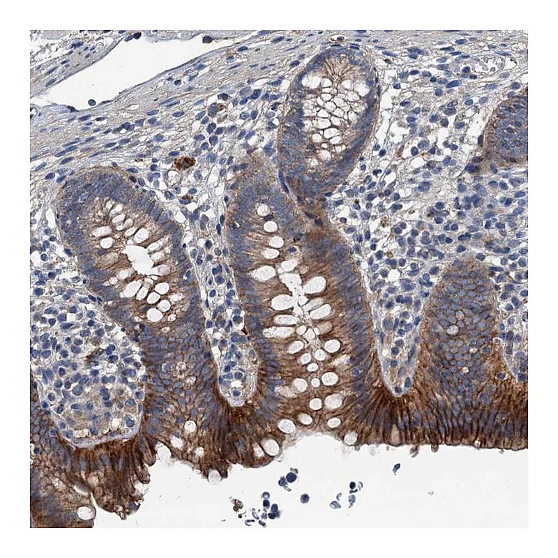 Atlas Antibodies Anti-SLC2A10 Antibody