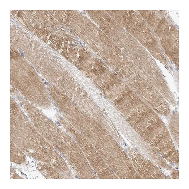 Atlas Antibodies Anti-SLC2A12 Antibody