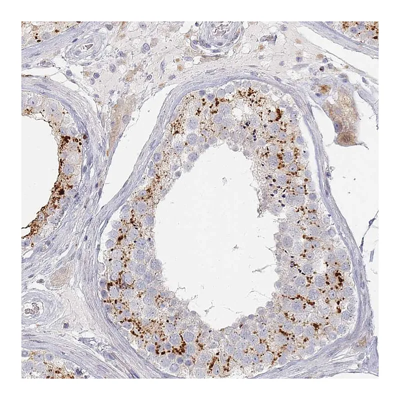 Atlas Antibodies Anti-SLC2A11 Antibody