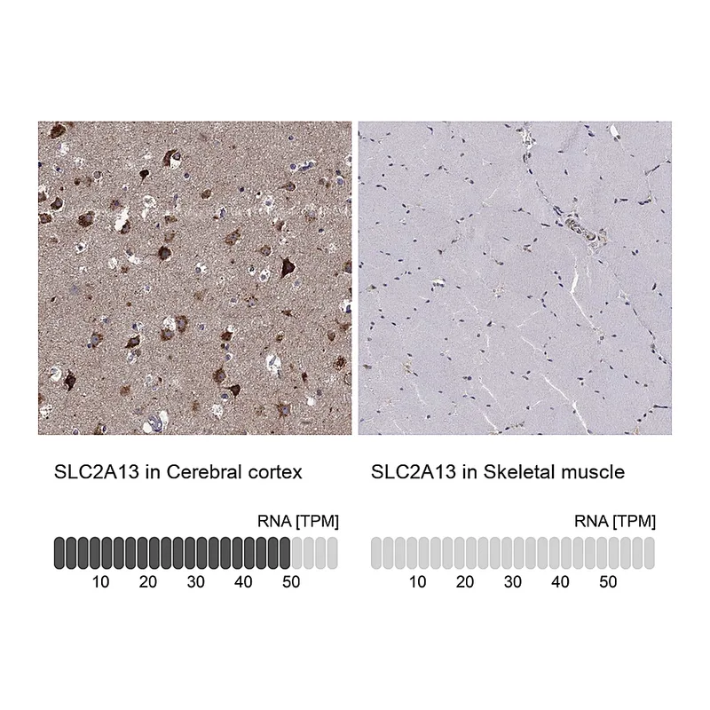 Atlas Antibodies Anti-SLC2A13 Antibody