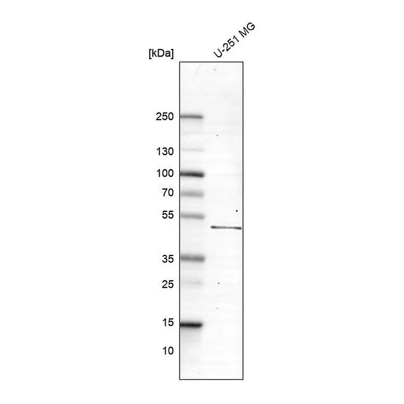 Atlas Antibodies Anti-SLC2A2 Antibody