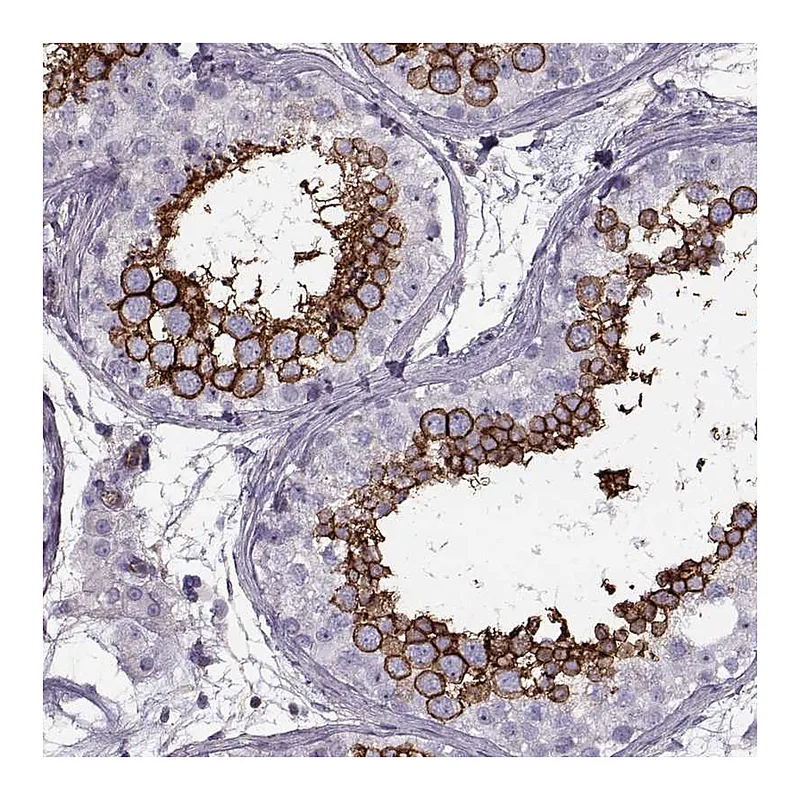 Atlas Antibodies Anti-SLC2A3 Antibody