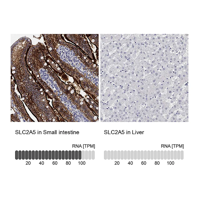 Atlas Antibodies Anti-SLC2A5 Antibody