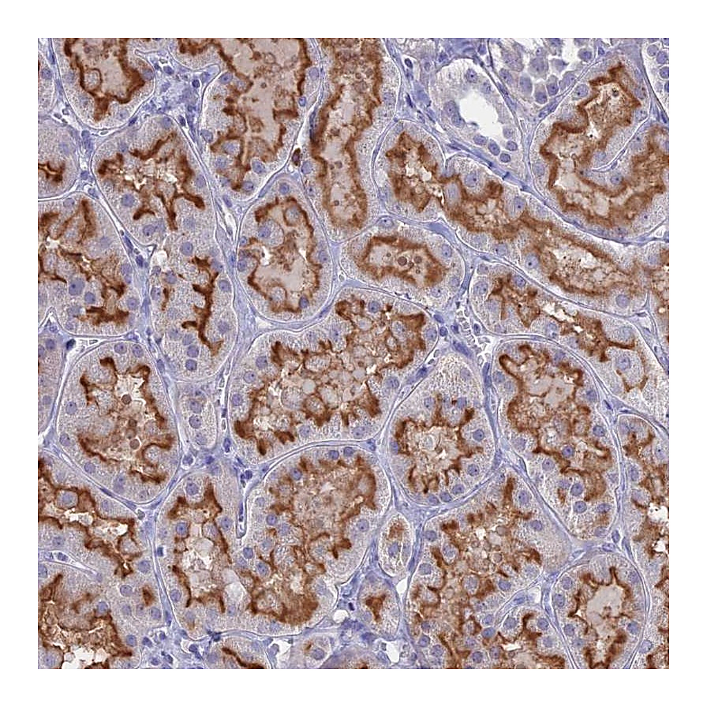 Atlas Antibodies Anti-SLC2A6 Antibody