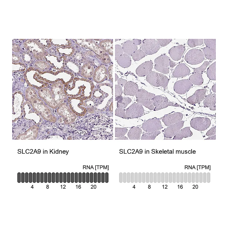 Atlas Antibodies Anti-SLC2A9 Antibody