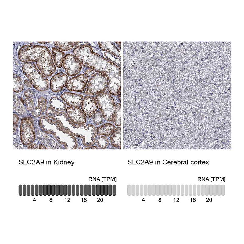 Atlas Antibodies Anti-SLC2A9 Antibody
