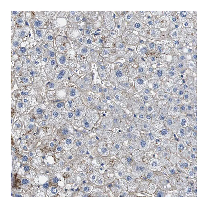 Atlas Antibodies Anti-SLC30A1 Antibody