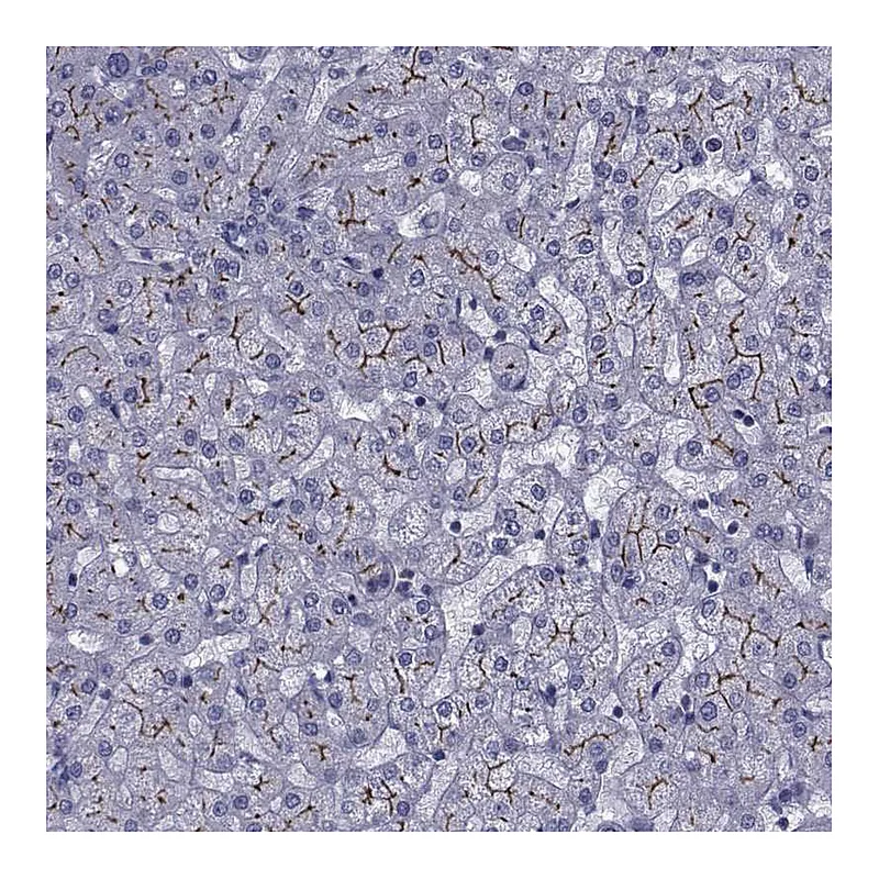 Atlas Antibodies Anti-SLC30A10 Antibody