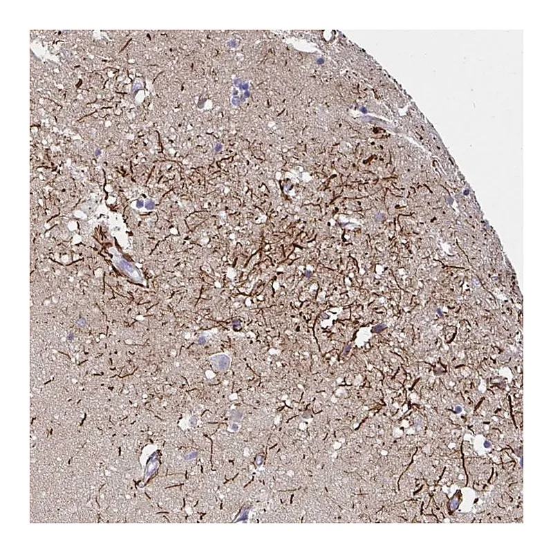 Atlas Antibodies Anti-SLC30A6 Antibody