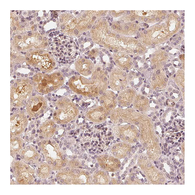 Atlas Antibodies Anti-SLC34A1 Antibody