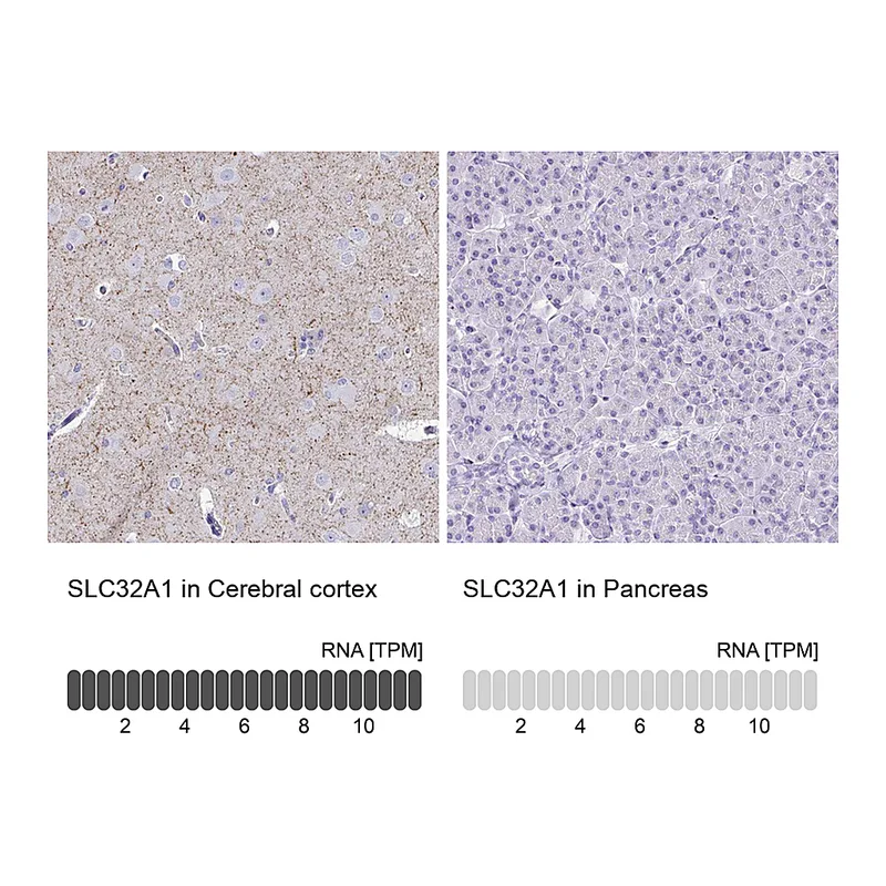 Atlas Antibodies Anti-SLC32A1 Antibody