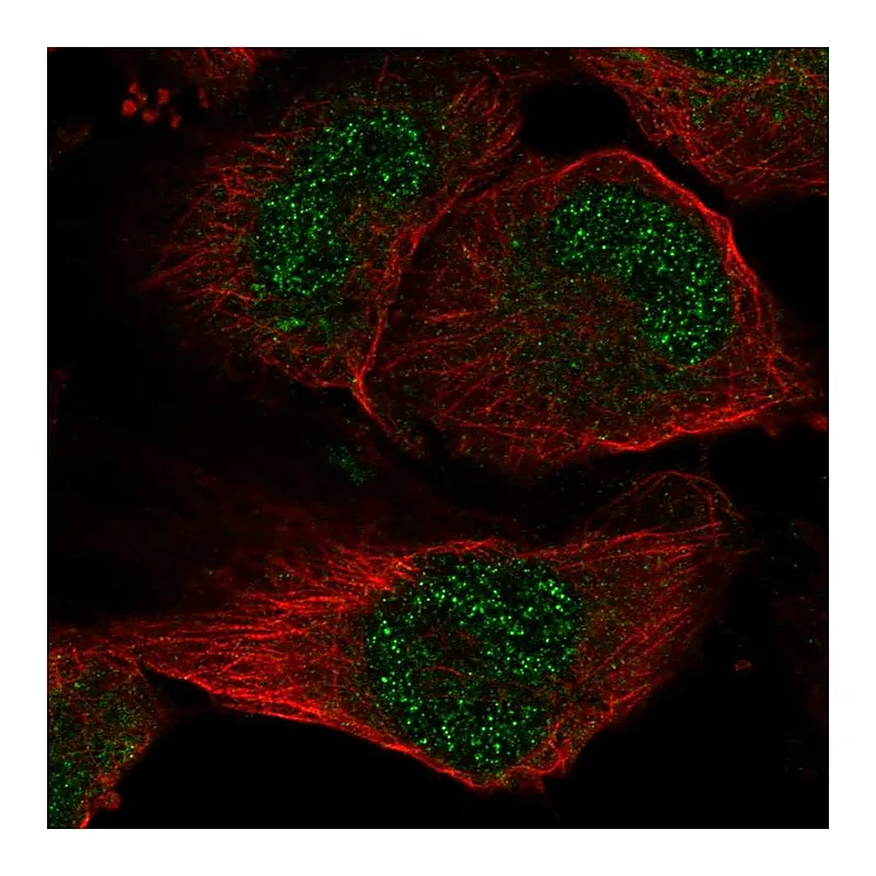 Atlas Antibodies Anti-SLC33A1 Antibody