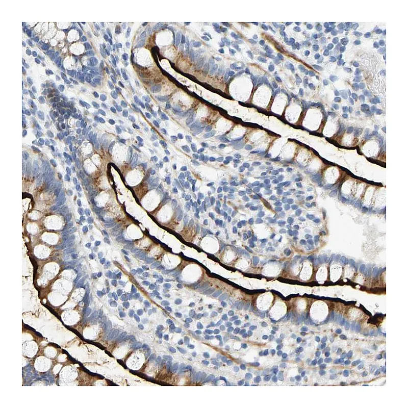 Atlas Antibodies Anti-SLC30A7 Antibody