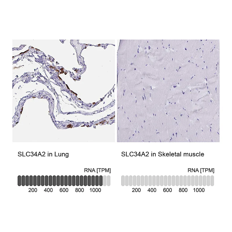 Atlas Antibodies Anti-SLC34A2 Antibody