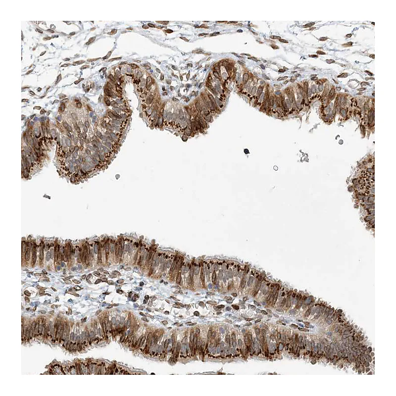 Atlas Antibodies Anti-SLC35A2 Antibody