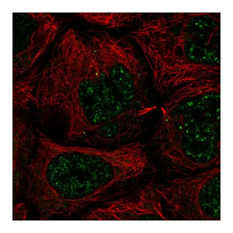 Atlas Antibodies Anti-SLC35A4 Antibody