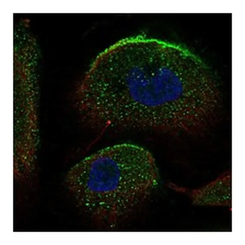 Atlas Antibodies Anti-SLC34A2 Antibody