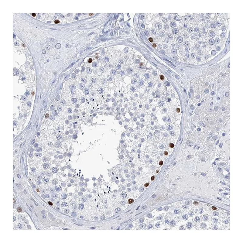 Atlas Antibodies Anti-SLC35A5 Antibody