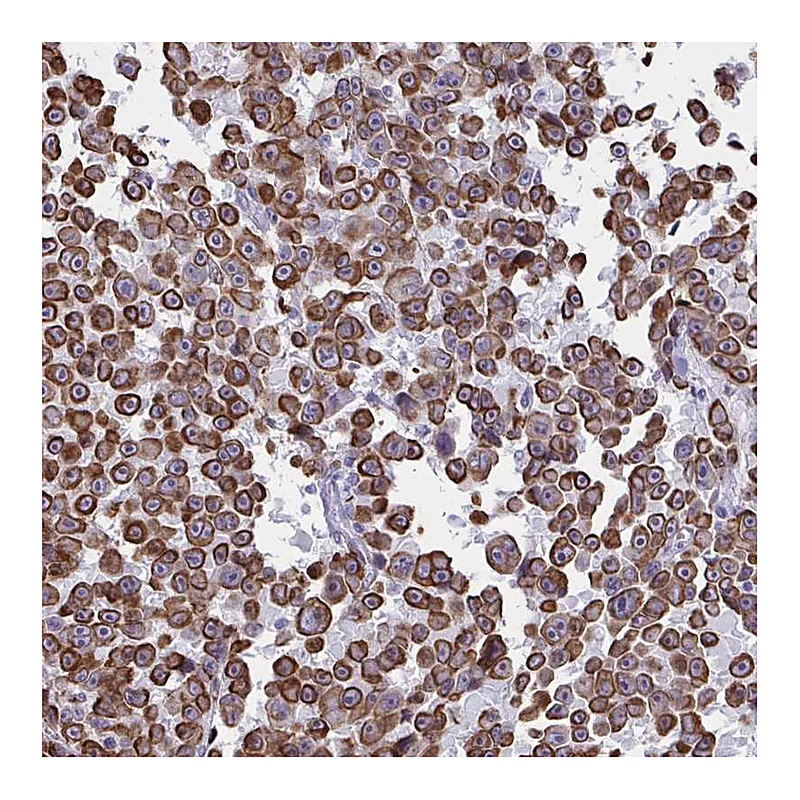 Atlas Antibodies Anti-SLC35B1 Antibody