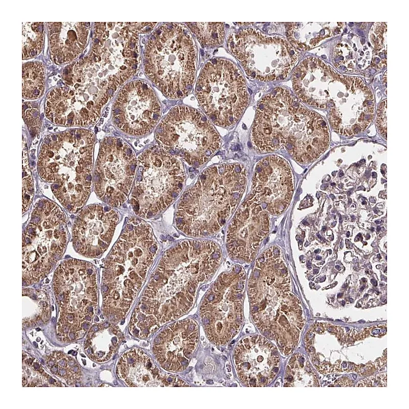 Atlas Antibodies Anti-SLC35D2 Antibody