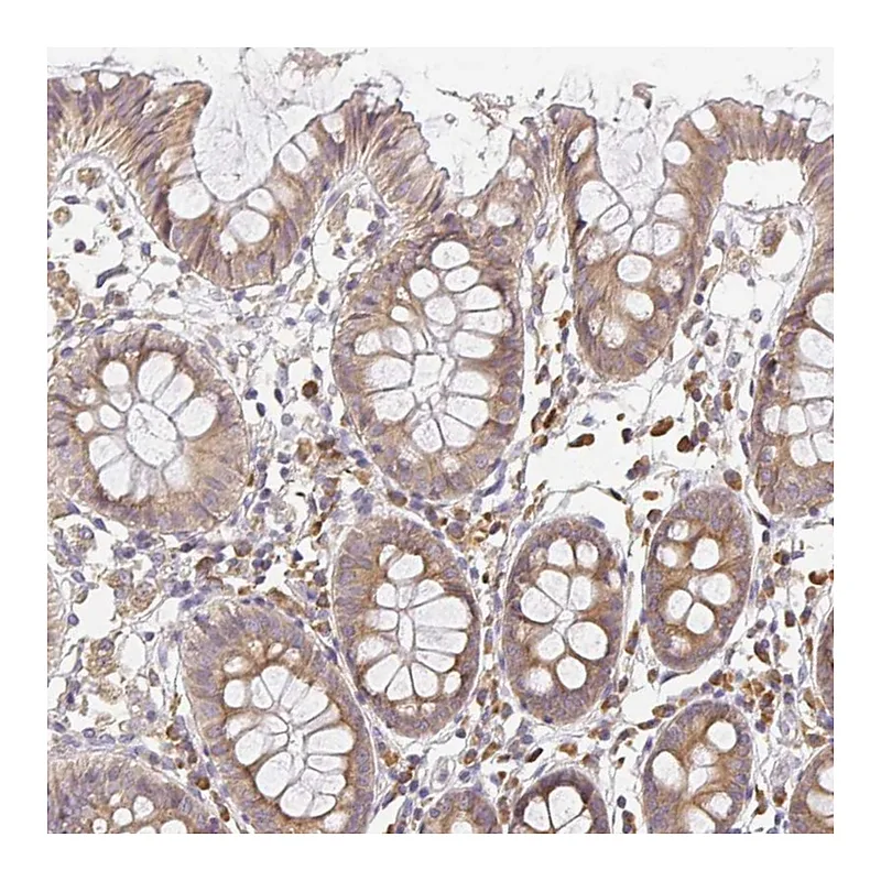 Atlas Antibodies Anti-SLC35B3 Antibody