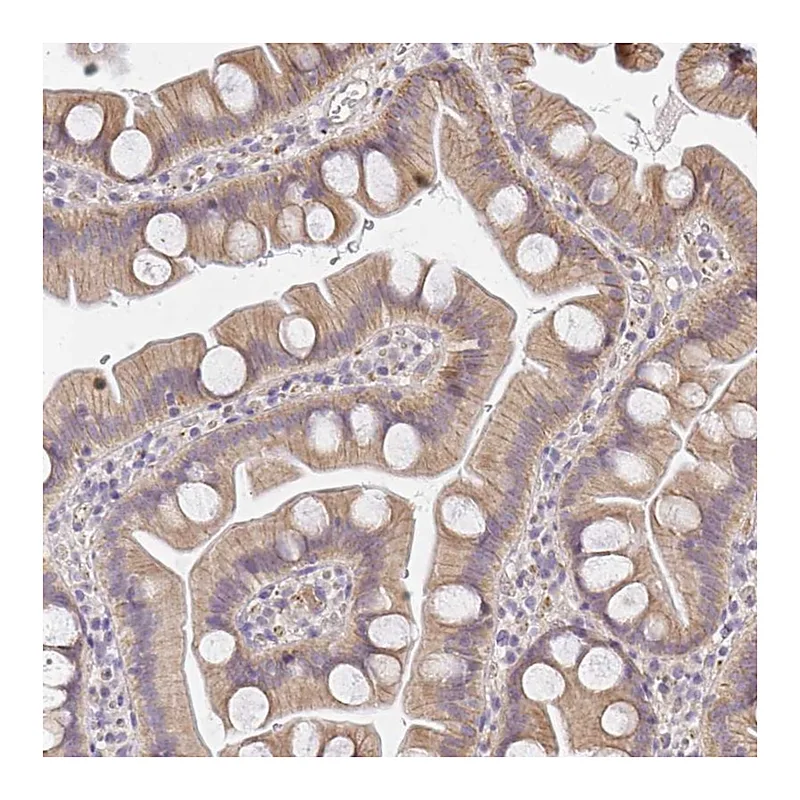 Atlas Antibodies Anti-SLC35B3 Antibody