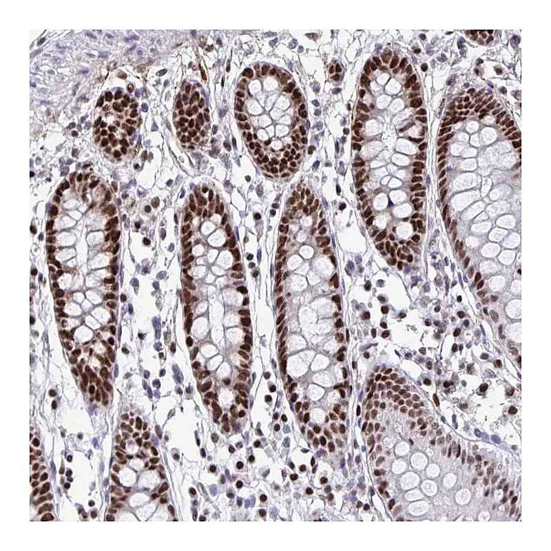 Atlas Antibodies Anti-SLC35C2 Antibody