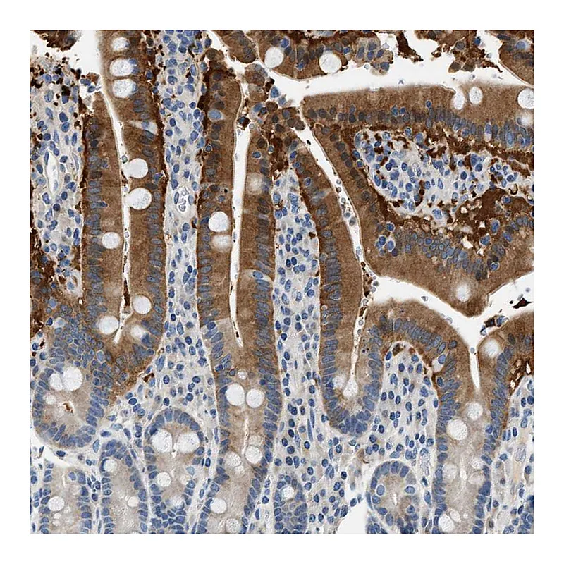 Atlas Antibodies Anti-SLC35E1 Antibody