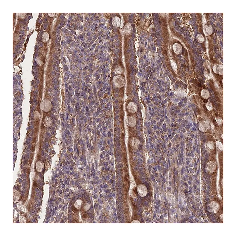 Atlas Antibodies Anti-SLC35B4 Antibody