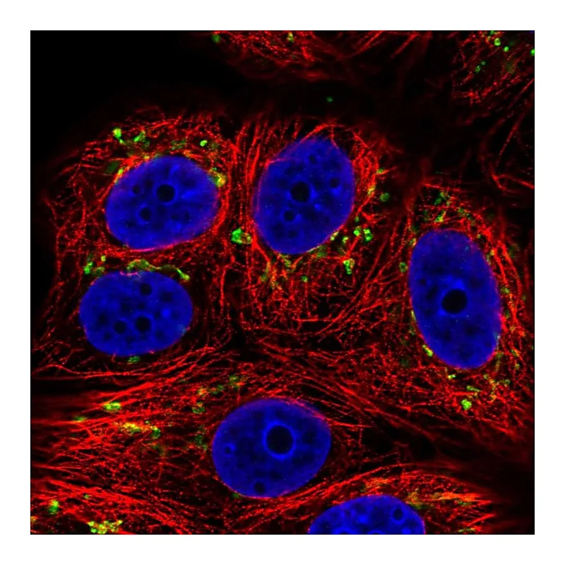 Atlas Antibodies Anti-SLC35E1 Antibody