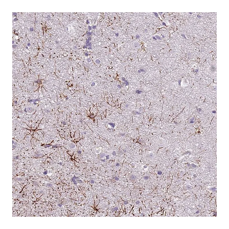 Atlas Antibodies Anti-SLC35E3 Antibody