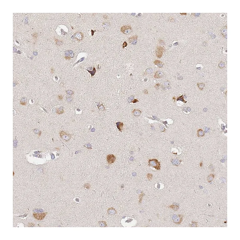 Atlas Antibodies Anti-SLC35F3 Antibody