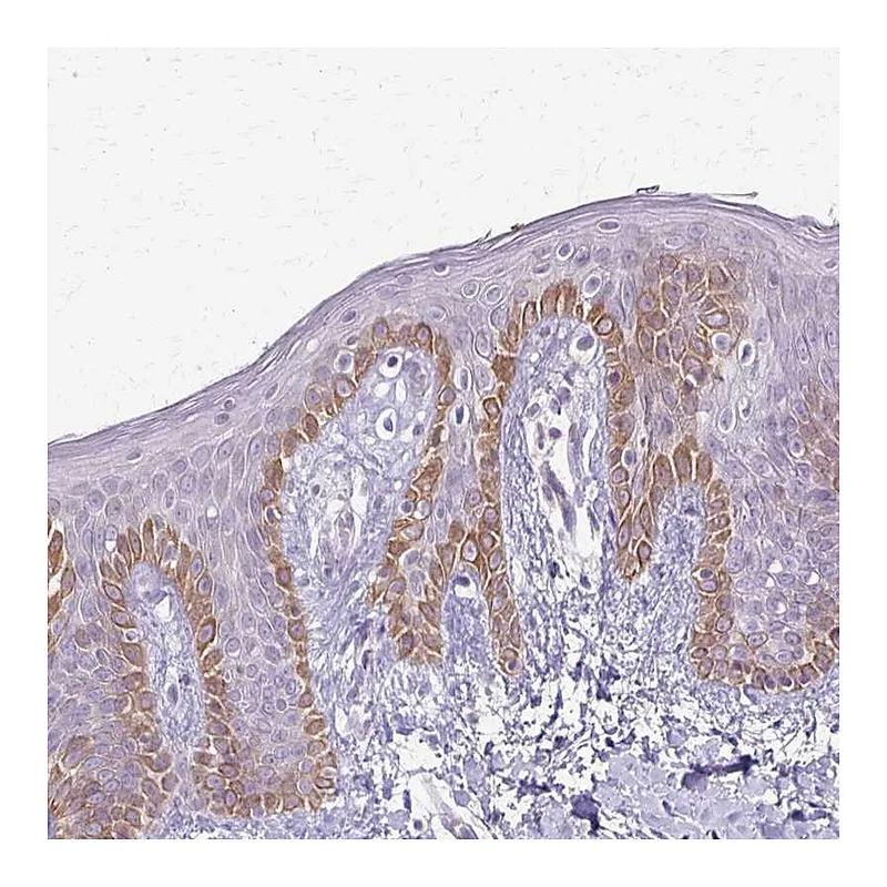 Atlas Antibodies Anti-SLC35E2 Antibody