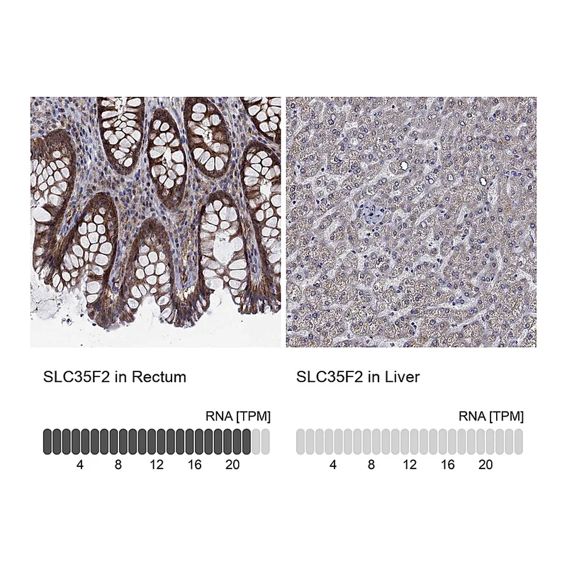 Atlas Antibodies Anti-SLC35F2 Antibody