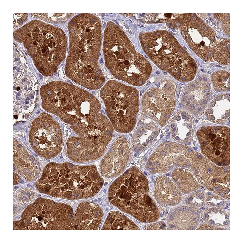 Atlas Antibodies Anti-SLC35E2B Antibody
