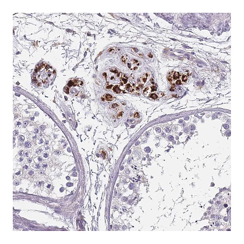 Atlas Antibodies Anti-SLC35E4 Antibody