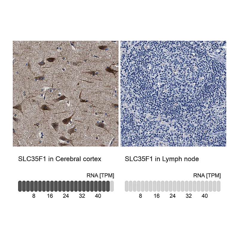 Atlas Antibodies Anti-SLC35F1 Antibody