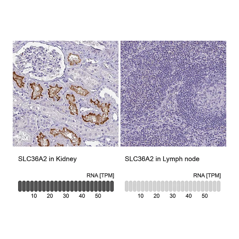 Atlas Antibodies Anti-SLC36A2 Antibody