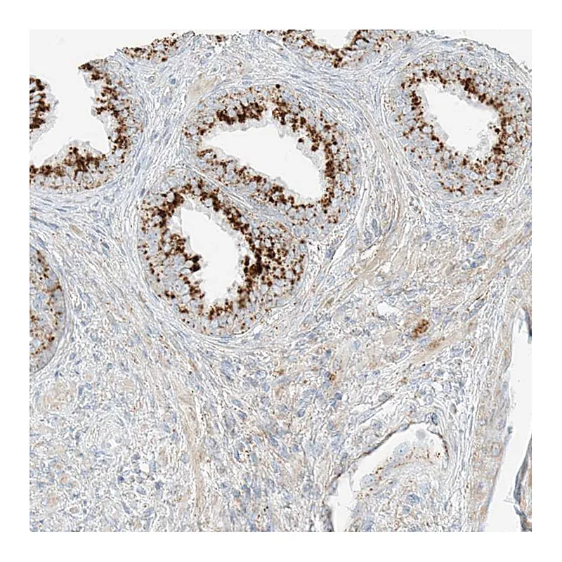 Atlas Antibodies Anti-SLC35F6 Antibody