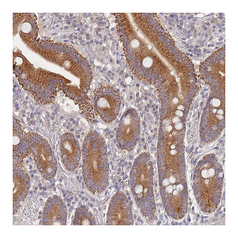 Atlas Antibodies Anti-SLC35F5 Antibody