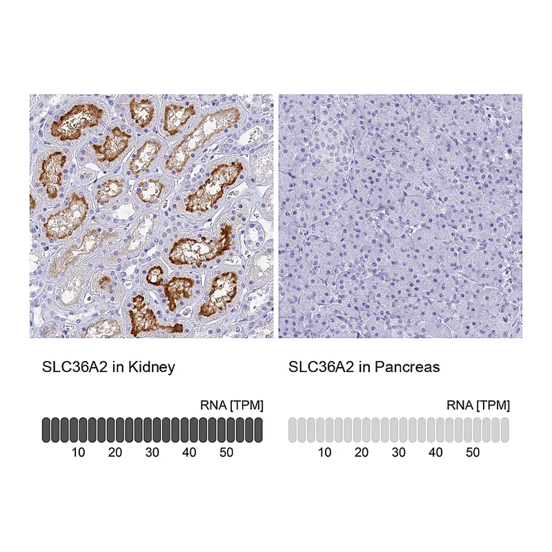 Atlas Antibodies Anti-SLC36A2 Antibody