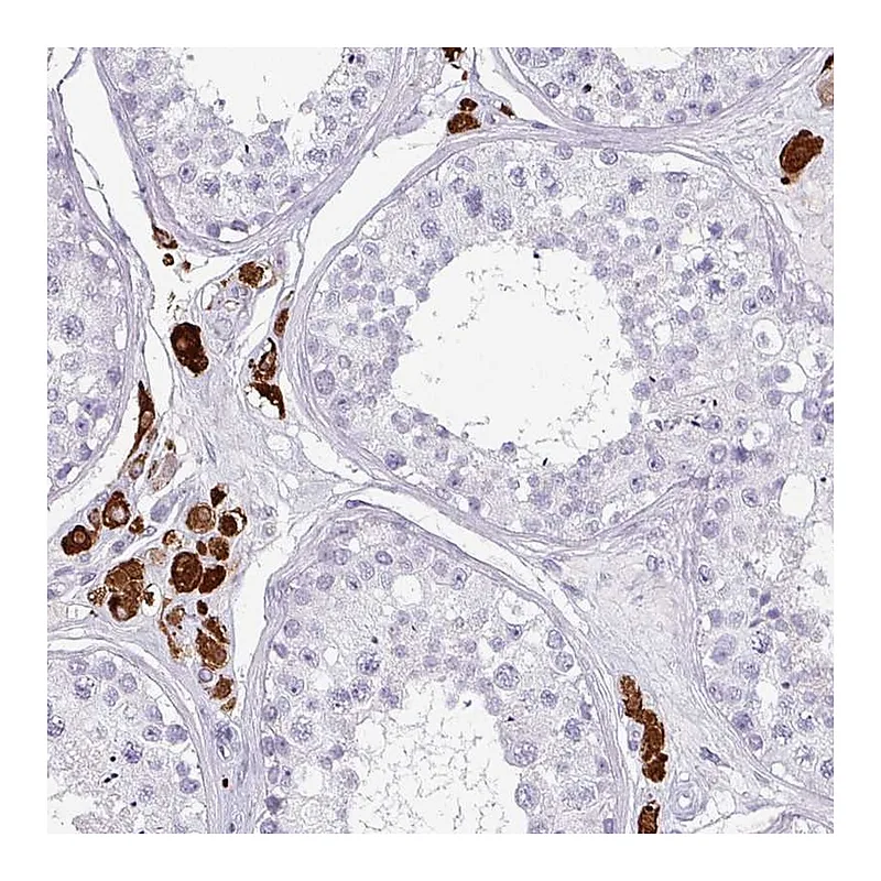 Atlas Antibodies Anti-SLC35G2 Antibody