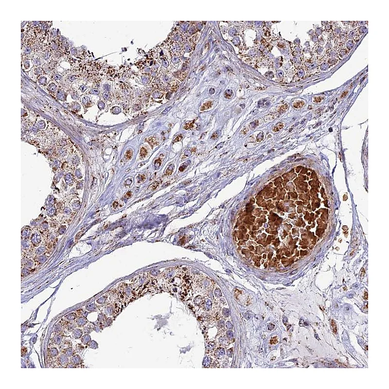 Atlas Antibodies Anti-SLC35F4 Antibody