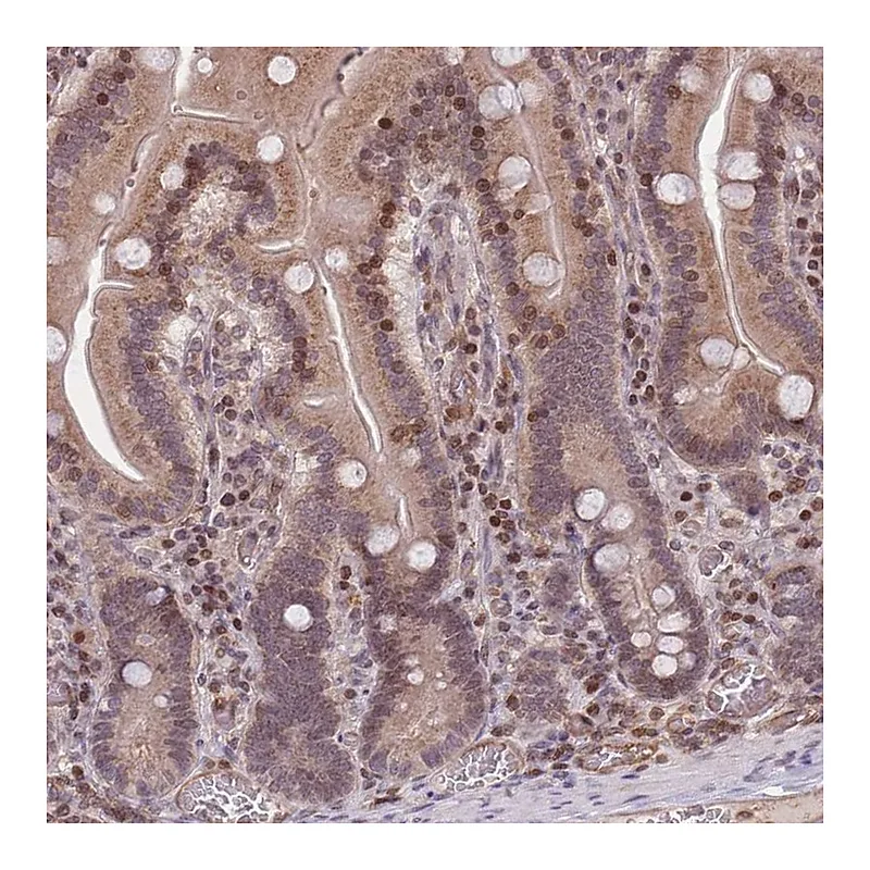 Atlas Antibodies Anti-SLC35F5 Antibody