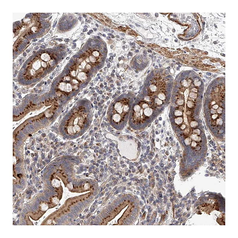 Atlas Antibodies Anti-SLC37A1 Antibody