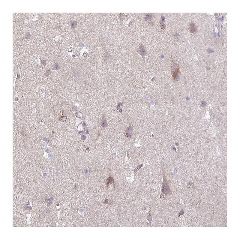 Atlas Antibodies Anti-SLC38A1 Antibody