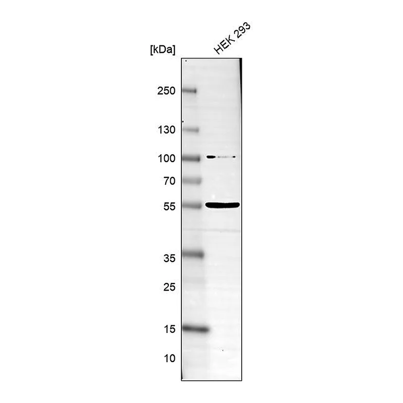 Atlas Antibodies Anti-SLC37A3 Antibody